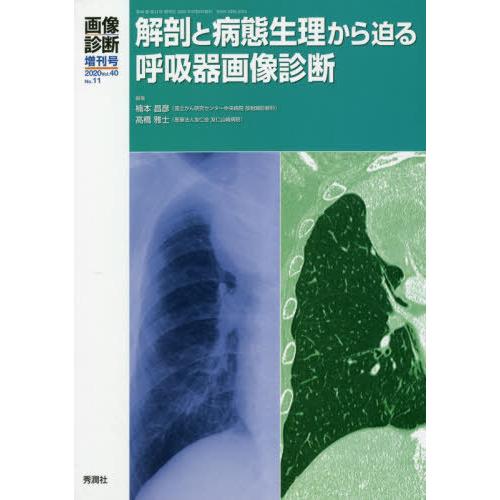 画像診断2020年増刊号 解剖と病態生理から迫る呼吸器画像診断