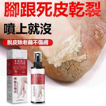隔日到貨🌷現貨🌷果酸足微精華噴霧 脚部角質死皮噴霧去死皮 防乾裂 質地清爽吸收快 軟化角質嫩膚 足部去角質 嫩足噴霧