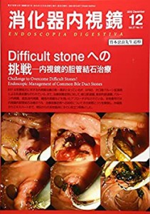 消化器内視鏡 15年12月号 27ー12 Difficult stoneへの挑戦(未使用 未開封の中古品)