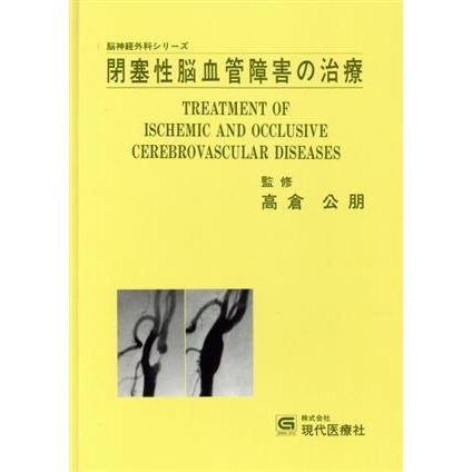 閉塞性脳血管障害の治療 脳神経外科シリーズ／病気