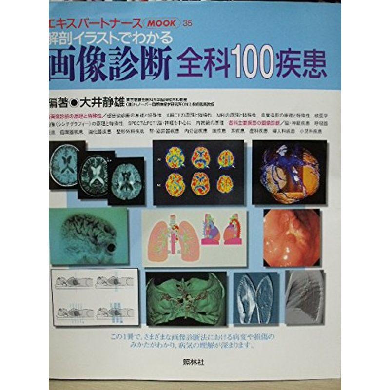 解剖イラストでわかる画像診断全科100疾患 (エキスパートナースMOOK (35))