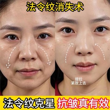 【屈臣氏爆賣】淡化法令紋嘴角紋提拉緊致提升凝水微晶貼非小工具