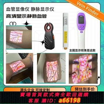 【台灣公司 可開發票】靜脈血管顯像儀四肢面部顯示儀輸液醫美醫用血管查找儀顯影儀外貿