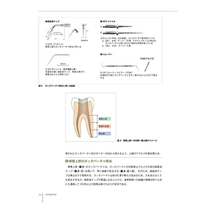 歯界展望別冊 再根管治療を見直す エンド専門医が伝える考え方・テクニック