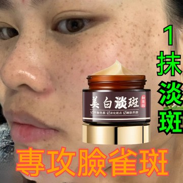 臺灣出貨同款Xodo面霜30g煙酰胺熊果苷 淡b 國妝特字淡化美白淡ban霜 淡化黑色素 美白霜乳霜亮白改善暗沉保濕補水
