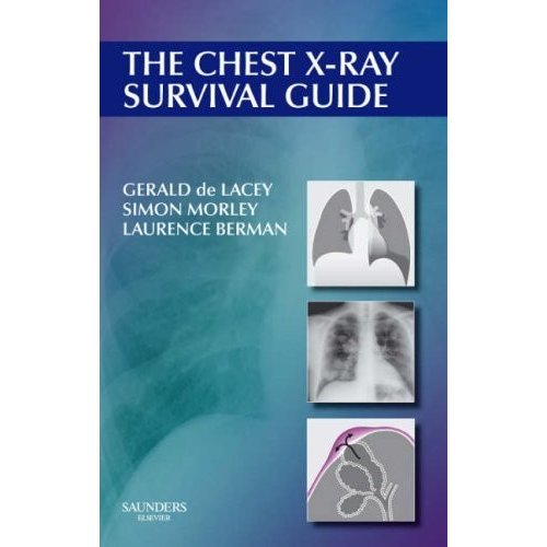 The Chest X-ray Survival Guide