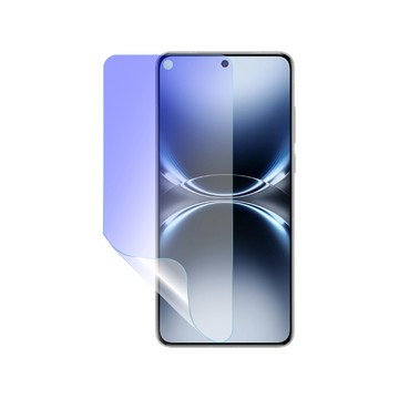 o-one 【護眼螢膜PRO】vivo X200 Ultra 螢幕保護貼 全新升級 阻隔藍光 輕薄抗擊