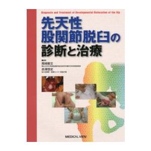 先天性股関節脱臼の診断と治療