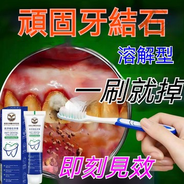 ✨隔日到貨【牙結石專用膏】 護理牙膏 牙結石牙膏 去除牙結石 牙周茶漬咖啡漬 去口臭黃煙漬抗敏感牙膏口腔清新呵護牙齒牙齦