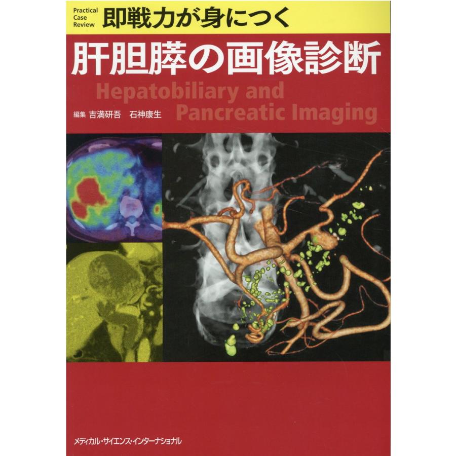 即戦力が身につく肝胆膵の画像診断