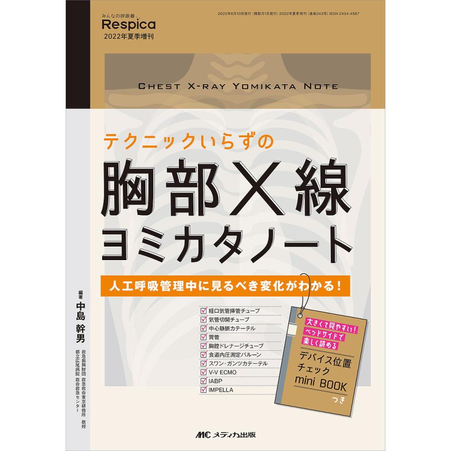 テクニックいらずの胸部X線ヨミカタノート 人工呼吸管理中に見るべき変化がわかる 中島幹男