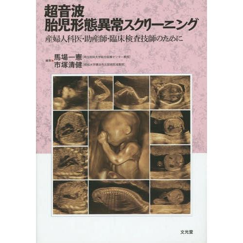 超音波胎児形態異常スクリーニング 産婦人科医・助産師・臨床検査技師のために