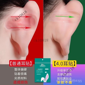 ✨可開發票#新陞級龍骨精靈耳貼拍證件照大臉顯小立耳貼貼麵耳秒變招風耳神器#免運費