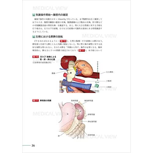 究める 腎・副腎腫瘍に対する腹腔鏡・ロボット支援手術