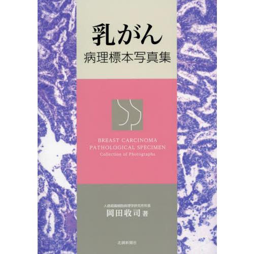 [本 雑誌] 乳がん 病理標本写真集 岡田收司 著