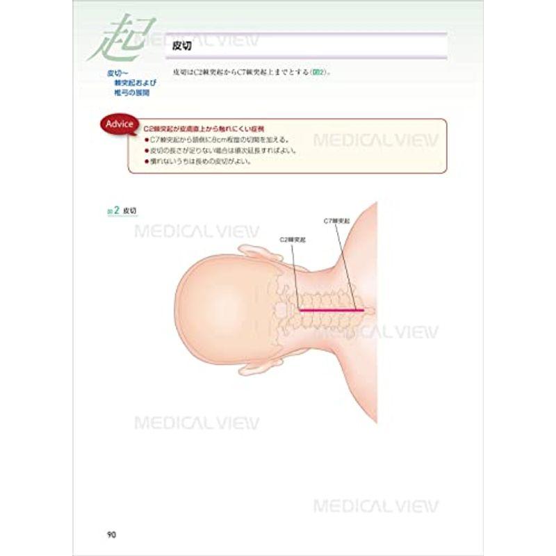 脊椎 (新 執刀医のためのサージカルテクニック)