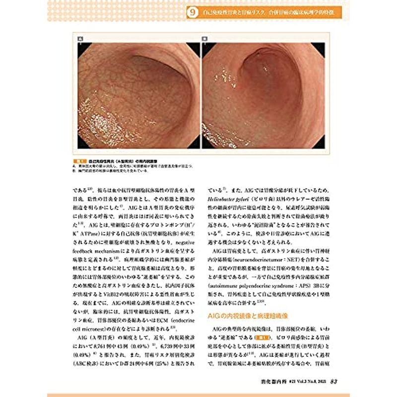 消化器内科 第21号(Vol.3 No.8,2021)特集:「胃炎の京都分類」と胃癌のスペクトラム