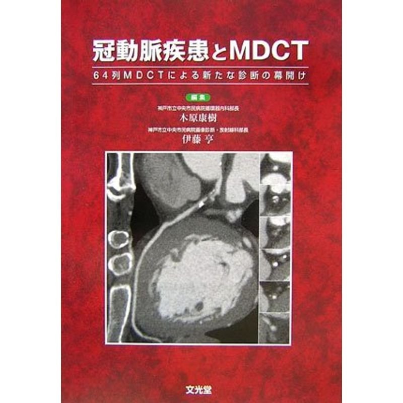 冠動脈疾患とMDCT?64列MDCTによる新たな診断の幕開け