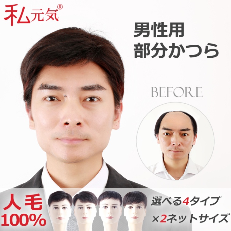 メンズ用 人毛100 トップカバー 部分ウィッグ メンズウィッグ ヘアピース 男性用 白髪 薄毛 円型脱毛症 トップピース 頭頂部 増毛 部分かつら 私元気 Bam 16 18cm ジェントルマンタイプ 通販 Lineポイント最大get Lineショッピング