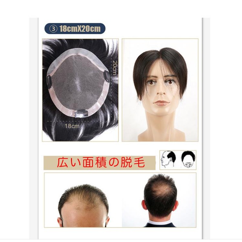 前髪ウィッグ ヘアピース メンズ かつら 男性 部分かつら 15*18cm 前PU