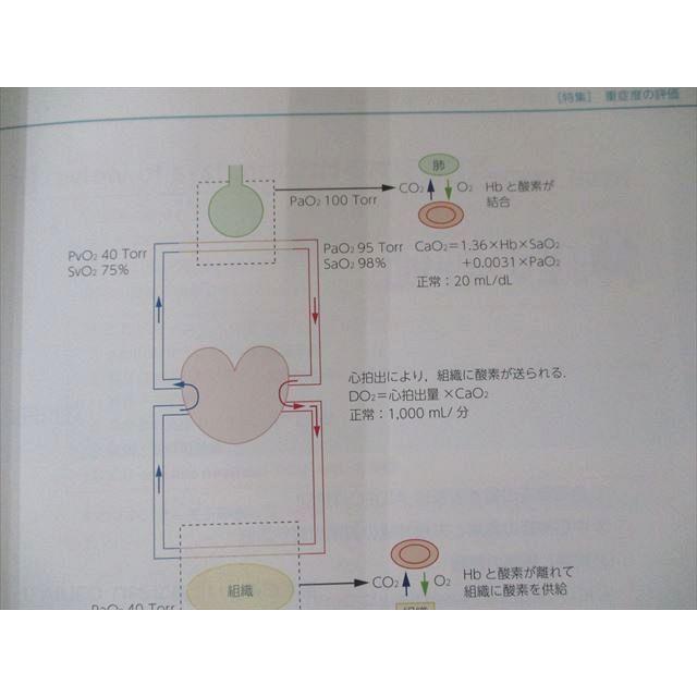 US82-168 羊土社 レジデントノート 2016年11月号 Vol.18 No.12 ICUの基本となる重症患者の全身評価 10m1B