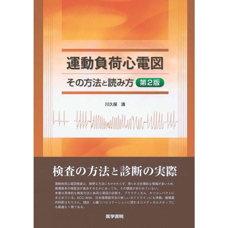 運動負荷心電図?その方法と読み方