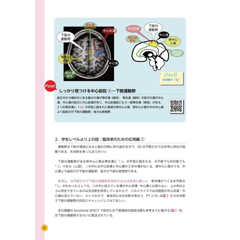 国家試験にも臨床にも役立つ リハビリPT・OT・ST・Dr.のための脳画像の