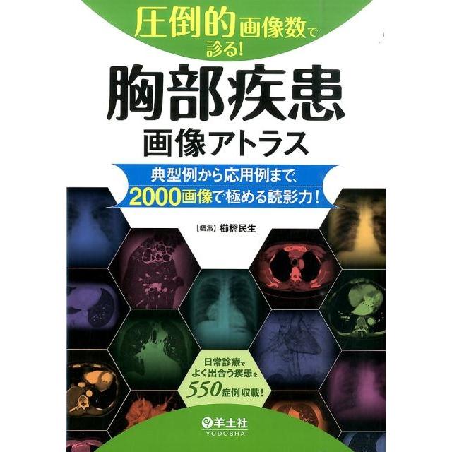 圧倒的画像数で診る 胸部疾患画像アトラス~典型例から応用例まで,2000画像で極める読影力