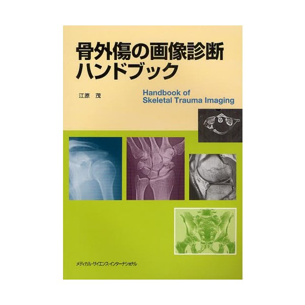 骨外傷の画像診断ハンドブック