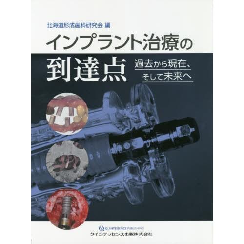 インプラント治療の到達点