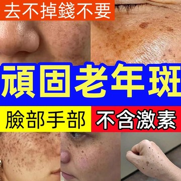 台灣隔日達🔥 斑點霜 黑點霜 黃褐斑 雀斑 曬斑 妊娠斑 老年斑 提亮膚色 煥白提亮 補水保濕 淡斑精華 超好用