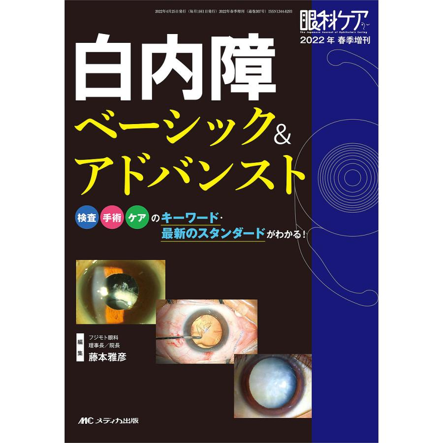 白内障ベーシック アドバンスト 検査・手術・ケアのキーワード・最新のスタンダードがわかる