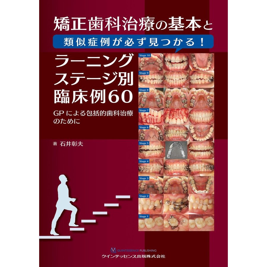 矯正歯科治療の基本と類似症例が必ず見つかる ラーニングステージ別臨床例60