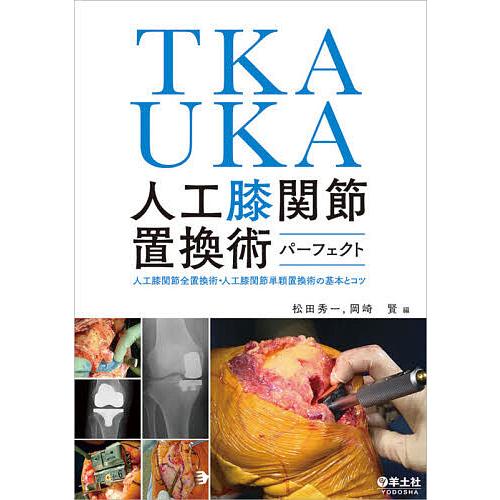 TKA・UKA 人工膝関節置換術パーフェクト 人工膝関節全置換術・人工膝関節単顆置換術の基本とコツ