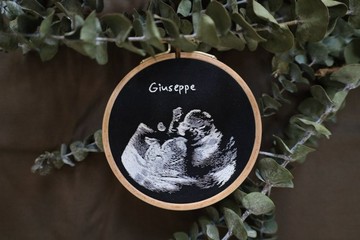 嬰兒超聲波/超音波刺繡
