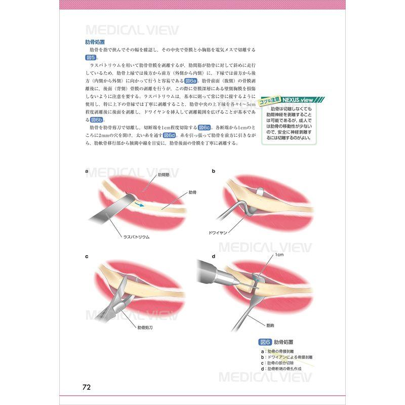 末梢神経障害・損傷の修復と再建術 17)