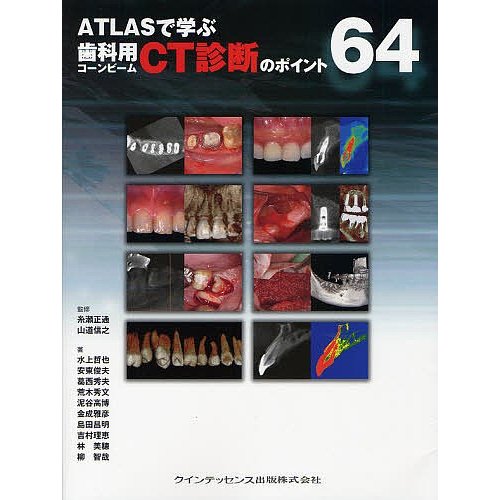 ATLASで学ぶ歯科用コーンビームCT診断のポイント64 糸瀬正通 山道信之 水上哲也