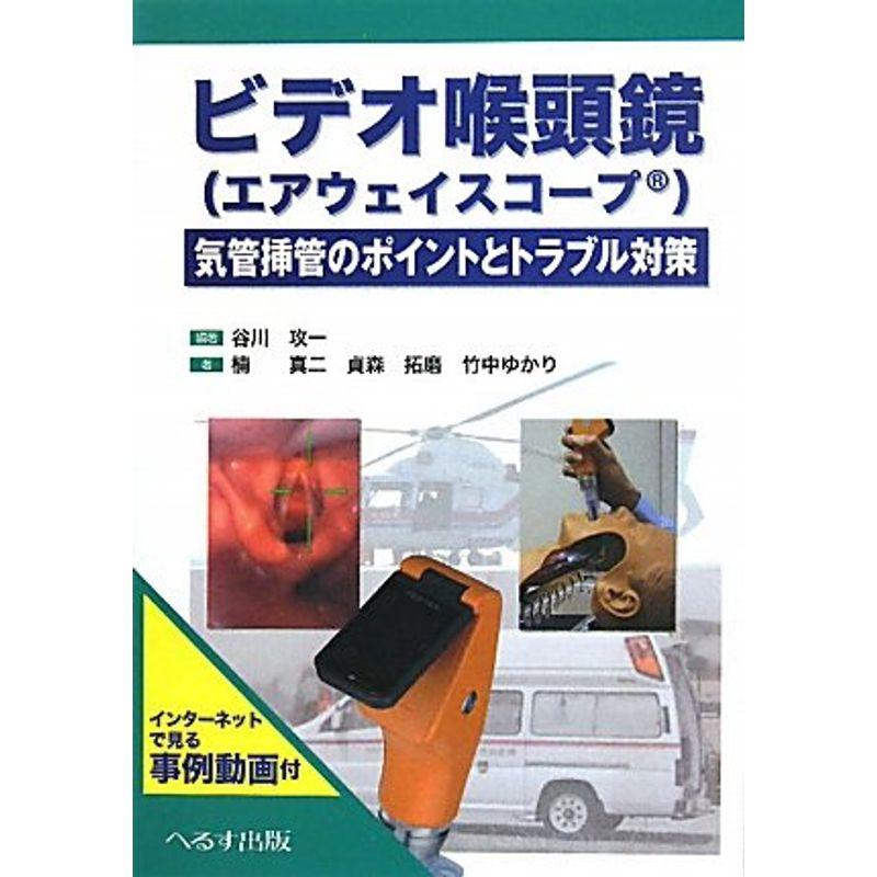 ビデオ喉頭鏡(エアウエイスコープ)?気管挿管のポイントと対策