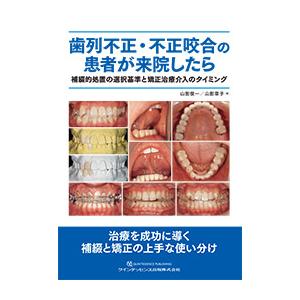 歯列不正・不正咬合の患者か?来院したら 補綴的処置の選択基準と矯正治療介入のタイミンク?