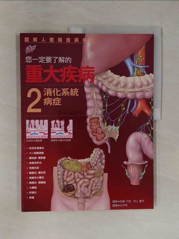 【書寶二手書T1／醫療_ZBW】您一定要了解的重大疾病 2消化系統病症_佐藤千史、井上智子