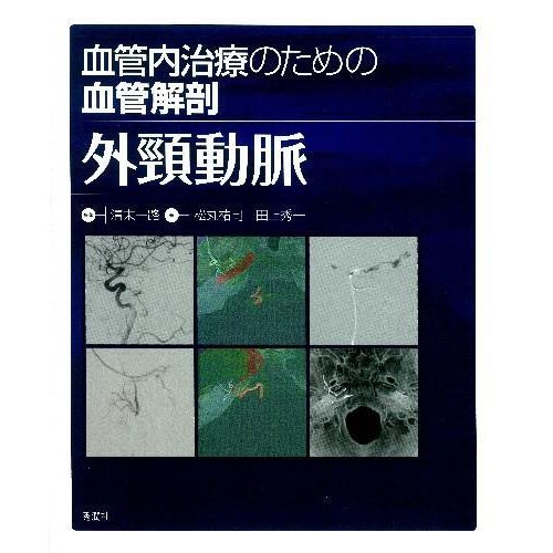 血管内治療のための血管解剖外頸動脈