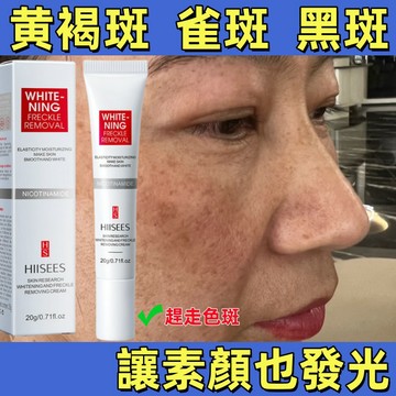 現貨秒發🚂買2送3【熱銷🔥】斑 老人斑 雀斑 斑點 黃褐斑 曬斑 黑色素 黑斑 毛孔 發黃 美容養顏 遠離黃氣