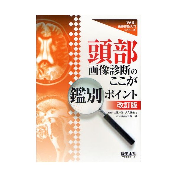 頭部画像診断のここが鑑別ポイント