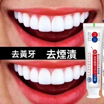 臺灣出貨 牙縫寬大修復神器門牙縫隙大矯正吃飯塞牙塞肉牙齒縫隙填充劑牙膏 再生硅牙膏護齦固齒修防蛀牙復牙釉質去黃清潔牙漬除