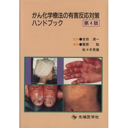 がん化学療法の有害反応対策ハンドブック／栗原稔(著者),佐々木常雄(著者)