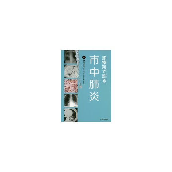 診療所で診る市中肺炎