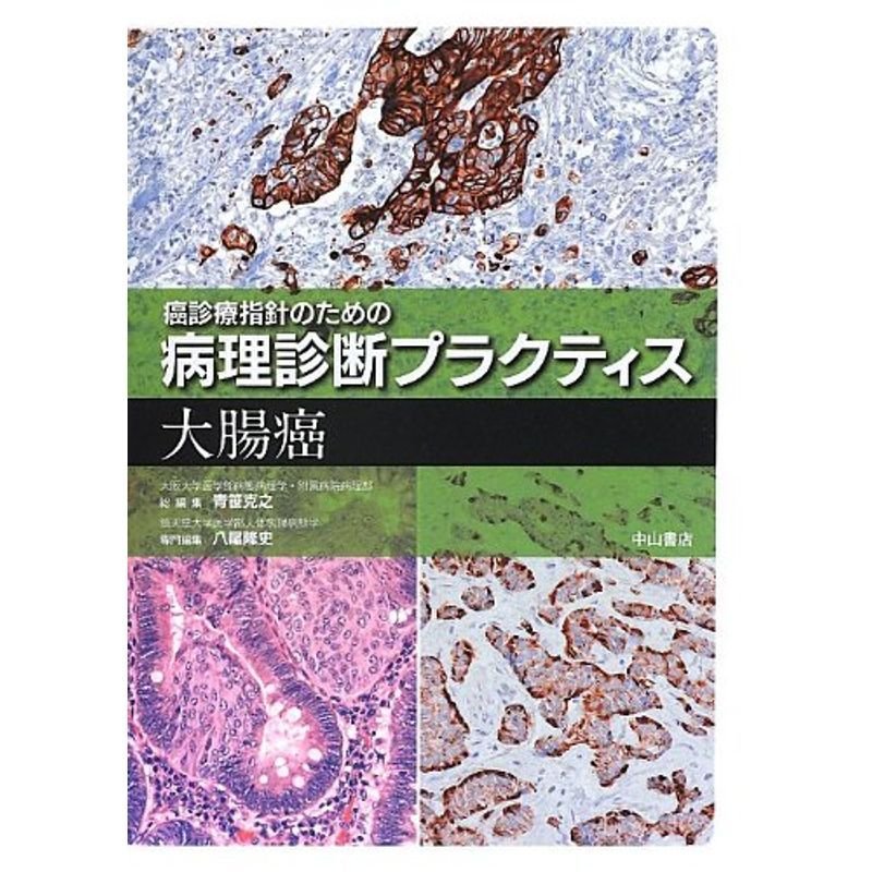 大腸癌 (癌診療指針のための病理診断プラクティス)