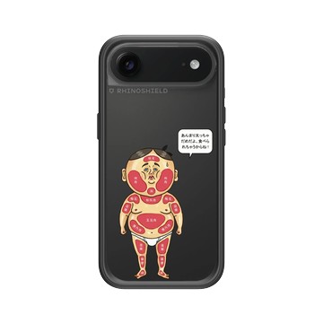 iPhone Air Mod NX -邊框背蓋組合 (相機按鈕) 黑 - 保羅先生 Mr.Paul - 圖解人體部位