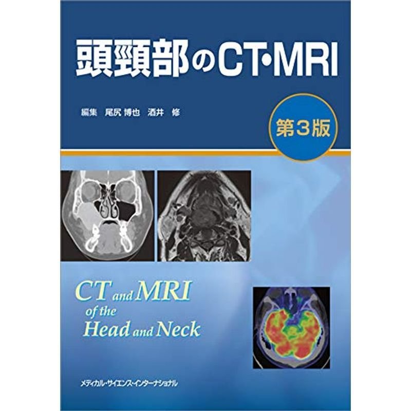 頭頸部のCT・MRI 第3版