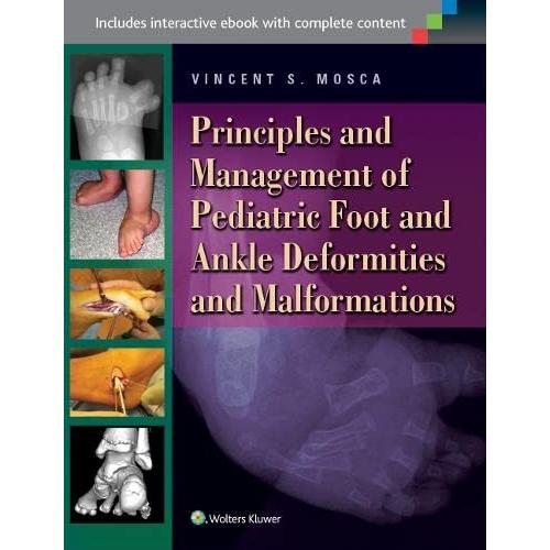 Principles and Management of Pediatric Foot and Ankle Deformities